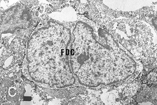 Fig. 4. Expression of TNFR I in tonsillar lymphoid follicle. (A and B) Immunostains of TNFR I. A lacy positive pattern (A) is evident in the apical and basal light zones. High-power view of the basal light zone, showing a heavily labeled lacy pattern (B). MZ, mantle zone; LZ, light zone; DZ, dark zone. (A) Original magnification × 98, (B) Original magnification × 300. (C and D) Immunoelectron micrographs of TNFR I in the tonsillar light zone. The cell surface of a binucleated FDC and the surface of the labyrinth-like structure of FDC embracing lymphocyte (L) are positively stained. Bar = 1 nm. (C) Original magnification × 5,700, (D) Original magnification × 10,080.