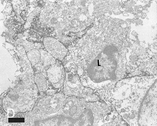 Fig. 4. Expression of TNFR I in tonsillar lymphoid follicle. (A and B) Immunostains of TNFR I. A lacy positive pattern (A) is evident in the apical and basal light zones. High-power view of the basal light zone, showing a heavily labeled lacy pattern (B). MZ, mantle zone; LZ, light zone; DZ, dark zone. (A) Original magnification × 98, (B) Original magnification × 300. (C and D) Immunoelectron micrographs of TNFR I in the tonsillar light zone. The cell surface of a binucleated FDC and the surface of the labyrinth-like structure of FDC embracing lymphocyte (L) are positively stained. Bar = 1 nm. (C) Original magnification × 5,700, (D) Original magnification × 10,080.