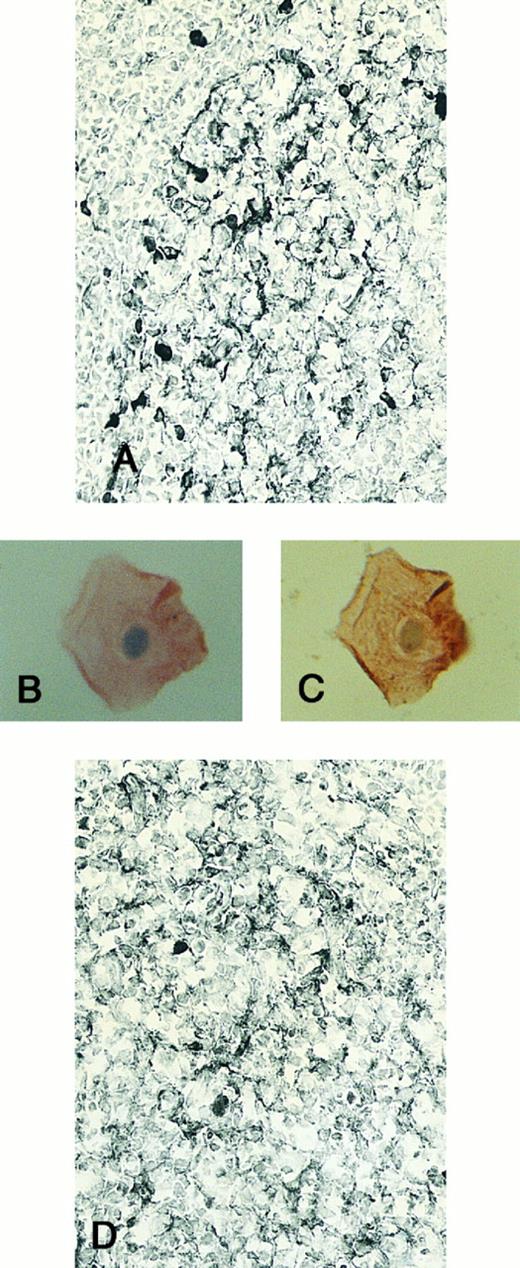 Fig. 5. Expression of IL-4 R and IL-6R in tonsillar lymphoid follicle. (A and D) Immunostains of IL-4R (A) and IL-6R (D). There is a positive lacy pattern of dendritic-shaped cells as well as a few lymphocytes mainly in the light zone. Counterstained with methyl green. (A and D) Original magnification × 328. (B, C, and E) Immunocytochemical stainings of IL-4R (B, single staining of IL-4R; C, double staining of IL-4R and R4/23) and IL-6R (E, single staining of IL-6R) on isolated FDCs. The positive reaction on FDCs is found. Counterstained with hematoxylin. (B), (C), and (E) Original magnification × 1,280.