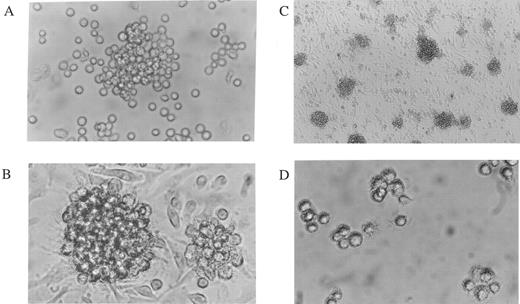 Fig. 2. Generation of mature DCs by culturing murine Lin−c-kit+ HPCs in the presence of mouse TNFα, GM-CSF, and SCF. Morphologic analyses were performed on cultured cells (A through D) or Giemsa-stained cells after cytocentrifugation (E through H). (A through D) A phase contrast microscopic observation was performed on murine Lin−c-kit+ HPCs stimulated by the combination of GM-CSF + SCF (A) or that of GM-CSF + SCF + mouse TNFα (B through D) for 5 (A and B) or 14 days (C) as described in Fig 1. In (D), the aggregates shown in (C) were isolated and observed for 2 hours after replating into a new plate. Original magnifications: (A), (B), and (D), × 200; (C), × 100. (E through H) Giemsa staining was performed after cytocentrifuging nonadherent cells or aggregate cells (from D) from murine Lin−c-kit+ HPCs cultured for 14 days in the absence (E and G) or in the presence of mouse TNFα (F and H) combined with GM-CSF and SCF. Original magnifications: (E) and (F), × 160; (G) and (H), × 400.