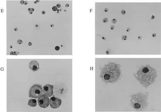 Fig. 2. Generation of mature DCs by culturing murine Lin−c-kit+ HPCs in the presence of mouse TNFα, GM-CSF, and SCF. Morphologic analyses were performed on cultured cells (A through D) or Giemsa-stained cells after cytocentrifugation (E through H). (A through D) A phase contrast microscopic observation was performed on murine Lin−c-kit+ HPCs stimulated by the combination of GM-CSF + SCF (A) or that of GM-CSF + SCF + mouse TNFα (B through D) for 5 (A and B) or 14 days (C) as described in Fig 1. In (D), the aggregates shown in (C) were isolated and observed for 2 hours after replating into a new plate. Original magnifications: (A), (B), and (D), × 200; (C), × 100. (E through H) Giemsa staining was performed after cytocentrifuging nonadherent cells or aggregate cells (from D) from murine Lin−c-kit+ HPCs cultured for 14 days in the absence (E and G) or in the presence of mouse TNFα (F and H) combined with GM-CSF and SCF. Original magnifications: (E) and (F), × 160; (G) and (H), × 400.
