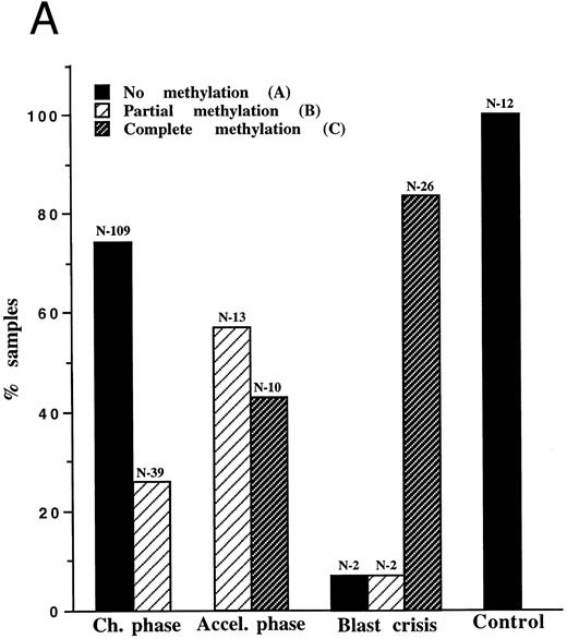 Fig. 1. (A) Pa methylation analysis in different phases of CML: 201 samples of 99 CML patients and 12 samples of non-CML patients underwent molecular analysis. The bars represent the ratio of samples characterized by patterns A, B, or C in each phase of the disease. The numbers (N) above the bars indicate the number of samples of a given pattern. (B) PCR analysis of Pa methylation of an individual patient in different phases of the disease: genomic DNA was cut with BamHI (1), Msp I (2), Bgl II (3), Sac II (4), and Hpa II (5). After digestion, samples were amplified by PCR and analyzed on ethidium-bromide agarose gel. On diagnosis, the patient displayed pattern A. Nineteen months later, the patient was still in the chronic phase, but the Sac II site was already methylated (pattern B). After an additional 5 months, the patient was in blastic crisis with evidence of methylation at both the Sac II and the Hpa II sites (pattern C).