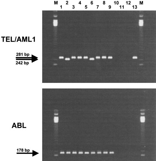 Fig. 1. RT-PCR detection of the TEL/AML1 fusion transcript. Upper panel, TEL/AML1 fusion transcript. Two different sizes of TEL/AML1 products are detectable (242 and 281 bp). To check integrity of the RNA, a 178-bp fragment of ABL was amplified from each patient (bottom panel). Lane M, 123-bp marker; lanes 1 to 9, patients no. 87086, 88615, 89100, 90568, 93437, 94112, 94565, 96526, 96569; lanes 10 to 12, water control for cDNA synthesis, first round of PCR, and second round of PCR; lane 13, positive control, REH cell line.