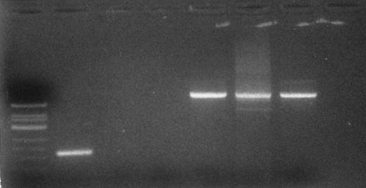 Fig. 2. Detection of cathepsin G mRNA transcripts in CD34+ CML blast cells. Total RNA was extracted from CD34+ CML blast cells. Ethidium bromide-stained gel of RT-PCR products. Lane 1 (left to right), molecular weight standard; lanes 2 and 5, CD34+ CML blast cells; lanes 3 and 6, normal CD34+ cells; lanes 4 and 7, breast cancer cell line as a negative control. Lanes 2 through 4 are RT-PCR products after amplification with cathepsin G primer set. Lanes 5 through 7 are RT-PCR products after amplification with β-actin primers and serve as a control.