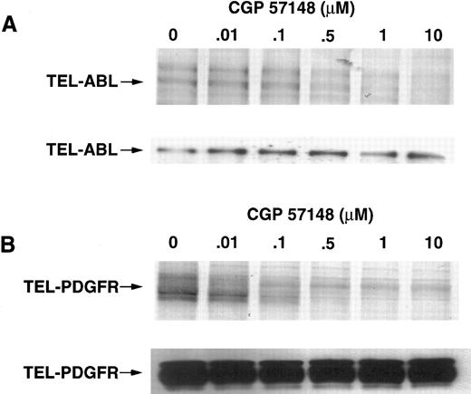 Fig. 3. IC50 of inhibition of TEL-ABL and TEL-PDGFR kinases. BaF3 TEL-ABL (A) or BAF3 TEL-PDGFR (B) cells were incubated for 1.5 hours in the presence of the indicated concentration of inhibitor. Cells were lysed and equal amounts of lysate were analyzed by immunoblotting with antiphosphotyrosine (top panel of A and B) or anti-ABL or anti-PDGFR antibodies (bottom panel of A and B). Data were analyzed as for Fig 2. The data shown are representative of two separate experiments and similar values were obtained for the IC50s.