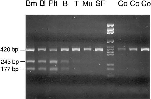 Fig. 10. Cell lineage involvement of the COX I mutation in patient no. 2. Total DNA was extracted from different types of cells: Bm, bone marrow; Bl, peripheral blood; Plt, platelets; B, B lymphocytes; T, T lymphocytes; Mu, buccal mucosa cells; SF, skin fibroblasts; Co, control bone marrow samples; lane 8, DNA size marker. In affected cell lineages, the COX I mutation creates a restriction site for Bsr I in the mtDNA segment nt 6504-6923, so that a considerable proportion of the 420-bp PCR product is cleaved into fragments of 243 and 177 bp.
