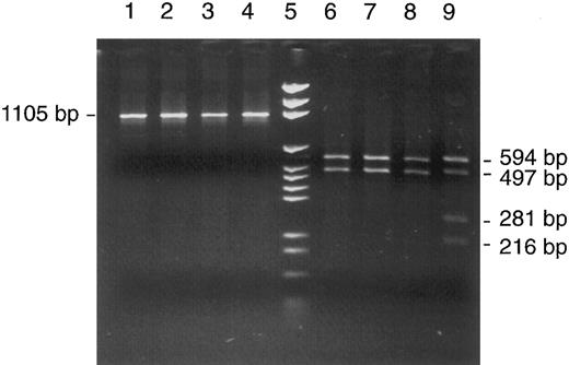 Fig. 2. Detection of a heteroplasmic mtDNA mutation in a bone marrow aspirate from patient no. 1. RFLP analysis of mtDNA segment 7 (nt 6504-7608) with Cfo I in four patients (lanes 1 through 4) and with Rsa I in the same four patients (lanes 6 through 9) showed an abnormal restriction pattern in patient no. 1 (lane 9); for explanation, see text. Lane 5, DNA size marker (pGEM).