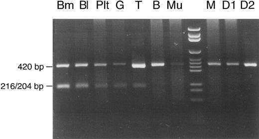 Fig. 3. Cell lineage involvement of the COX I mutation in patient no. 1. Total DNA was extracted from different types of cells: Bm, bone marrow; Bl, peripheral blood; Plt, platelets; G, erythrocyte/granulocyte pellet; T, T lymphocytes; B, B lymphocytes; Mu, buccal mucosa cells; lane 8, DNA size marker; M, peripheral blood from the mother of patient no. 1; D1 and D2, peripheral blood from the first and second daughter of patient no. 1. See text for explanation of the restriction pattern.