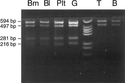 Fig. 4. Cell lineage involvement of the COX I mutation in patient no. 1. Immunomagnetic bead isolation of T and B lymphocytes was repeated with another peripheral blood sample, and a normal Rsa I restriction pattern of mtDNA segment 7 (nt 6504-7608) was obtained for T and B lymphocytes. For abbreviations, see Fig 3.