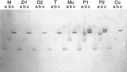 Fig. 8. Parallel TGGE. Same mtDNA fragment as in Fig 7. After denaturation and renaturation, each PCR product was brought onto the gel in triplicate at time intervals of 15 minutes (lanes a, b, and c, respectively). The running time was too long for the samples designated a and b, so that bands became diffuse. Clear bands can be seen in lanes c. M, D1, and D2, normal bands in the mother and two daughters of patient no. 1, respectively; T and Mu, normal bands in T lymphocytes and buccal mucosa cells of patient no. 1, respectively; P1 and P2, heteroduplex bands in patients no. 1 and 2, respectively; Co, normal bands in an additional control person.