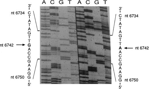 Fig. 9. Sequencing of the COX I mutation in patient no. 2. mtDNA heavy strand; normal sequence on the right, mutated sequence on the left. The pathologic clone showed an A → G transition at nt 6742. The complementary light strand was also sequenced and showed the expected T → C transition (data not shown).