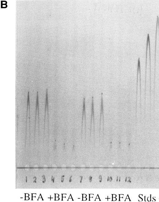 Fig. 1. Rocket immunoelectrophoresis of ferritin (A) and albumin (B) in hepatoma cell medium. (A) Rockets obtained with concentrated samples of conditioned medium from hepatoma cells in comparison with standards (Stds) of horse spleen ferritin (HSpFt) (3 slots on far right). Samples (6 lanes on the left) are from individual flasks of cells grown for 48 hours in protein-free medium (see Materials and Methods). Standards contained 10, 6, and 2 μg/mL horse spleen ferritin protein (from left to right). (B) Samples of medium from cells that were and were not treated with the Golgi function inhibitor, brefeldin A (+ BFA; 4 μg/mL), in comparison with rat albumin standards (Stds; 3 lanes on far right). Lanes 1 to 3 and 7 to 9 from left were from untreated cells, lanes 4 to 6 and 10 to 12 were from BFA treated cells, as indicated.