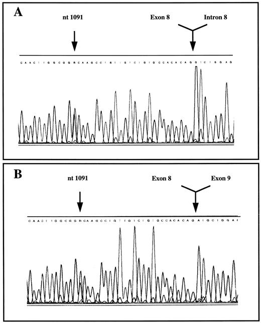 Fig. 2. Detection of the nucleotide G1091 to A mutation in exon 8 of the human PKLR gene and RNA of the proband by sequencing. (A) DNA; (B) RNA.