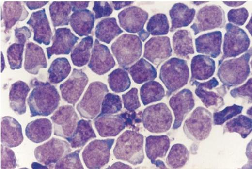 CD34+ cells purified from normal bone marrow using an antibody column. Cytocentrifuge preparation. (Courtesy of Alberto A. Marmont, MD, and Giovanna Piaggio, MD, Ospedale San Martino, Centro Trapianti di Midollo Osseo, Divisione Ematologia 2, 16132 Genova, Italy.)