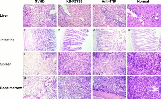 Fig. 3. Histopathological examination. Induction of lethal acute GVHD and administration of KB-R7785 or anti-TNF MoAb were performed as described in Fig 2. On day 10 for the GVHD group or day 14 for the other groups, 3 mice in each group were killed. Paraffin section of the liver, intestine, spleen, and bone marrow were stained by hematoxylin and eosin. Sections from age-matched normal CBF1 are also represented. (Original magnification × 100.)