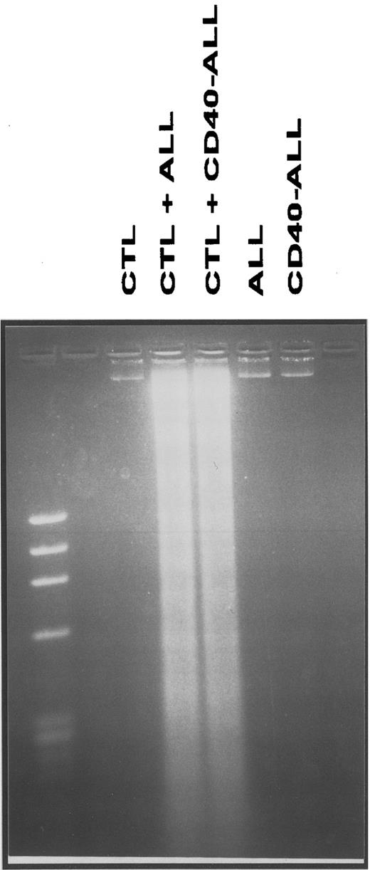 Fig. 4. DNA fragmentation of pre-B ALL cells following coculture with T-cell lines (CTL) generated and expanded from bone marrow bulk cultures. Cultures were performed as described in the Materials and Methods, and the effector:target ratio used was 40:1. This figure depicts case ALL-17 and is representative of three independent experiments (3 different patients).