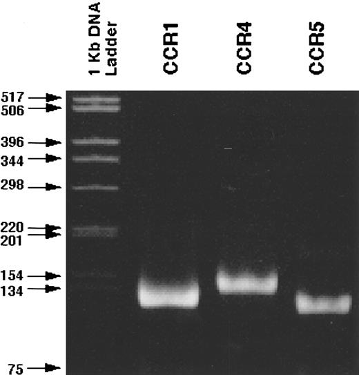 Fig. 4. Detection of the transcripts of CCR1, CCR4, and CCR5 in CD34+ normal BMMNCs. RT-PCR was performed as described in Materials and Methods. The specificity of the PCR products was confirmed by the determination of their nucleotide sequence (data not shown).