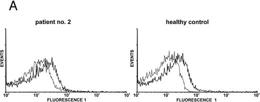 Fig. 1. Expression of c-Mpl on platelets from TAR patients. (A) c-Mpl expression on the surface of platelets as measured by flow cytometry (see Materials and Methods). Gray, isotype control; black, anti c-Mpl. (B) Detection of c-Mpl in platelet lysates after immunoprecipitation and Western-blot analysis with anti-c-Mpl antibody M1 (chemoluminescence detection, see Materials and Methods). Lane 1, healthy donor; lane 2, TAR patient no. 1.