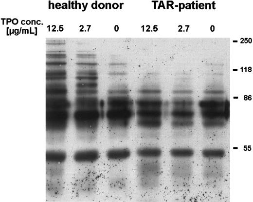 Fig. 3. Induction of tyrosine phosphorylation of platelet proteins after stimulation with rhTPO. Platelets (patient no. 5) were preincubated with different concentrations of rhTPO before lysis and Western-blot analysis with HRP-conjugated antiphosphotyrosine antibody (chemoluminescence detection) (see Materials and Methods)