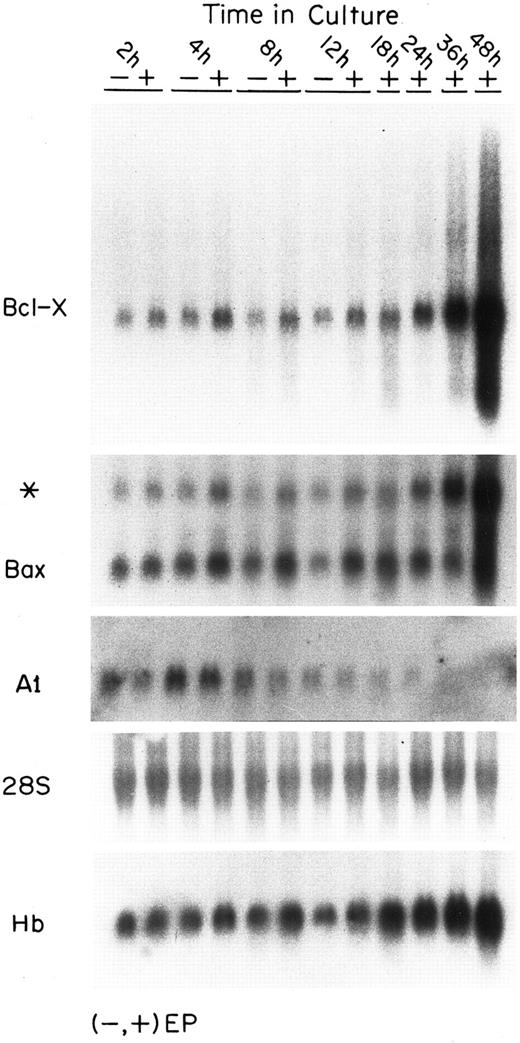 Fig. 1. Expression of mRNAs for several Bcl-2–related genes in FVA cells. Each panel shows the steady-state levels of mRNA for the indicated gene. All panels represent the same blot probed successively with various probes. Each lane contained 20 μg of total RNA taken from FVA cells cultured with or without EP and harvested at the designated time points. The first panel shows the blot probed with a bcl-x probe. The second panel shows the blot reprobed without stripping with a bax probe (* band is residual bcl-x probe activity). The third panel shows the blot after stripping and reprobing with an A1 probe. The probes for bcl-x, bax, and A1 were approximately equal in size (∼600 bp) and all labeling and hybridization conditions were similar. Film exposure times were 24 hours for bcl-x and bax and 172 hours for A1. The fourth panel shows the blot stripped and reprobed with a 28S rRNA probe. The bottom panel shows the blot stripped and reprobed with a β-globin probe (designated Hb).