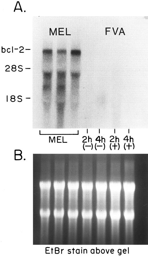 Fig. 2. Lack of bcl-2 mRNA in FVA cells. (A) The steady state levels of mRNA detected by a probe specific for bcl-2. The first three lanes contained RNA taken from cells of a MEL cell line. From left to right, each lane contained 20 μg of total cellular RNA from control cells and from cells after 4 and 5 days of exposure to 2% dimethyl sulfoxide (added to induce differentiation of the cells). The last four lanes on the right each contained 20 μg of total RNA taken from EP-treated (+) or EP-deprived (−) FVA cells at 2 and 4 hours. (B) A photograph of the formaldehyde/agarose gel stained with EtBr to show the RNA in the lanes.
