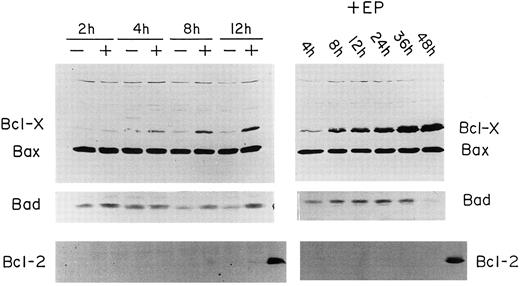 Fig. 3. Western blot analysis of Bcl-2 protein family in FVA cells. The left side of each panel shows the protein levels after 2, 4, 8, and 12 hours of EP-deprived (−) and EP-exposed (+) FVA cells. The right side of each panel shows the long-term developmental expression of proteins in EP-treated cells. These lanes depict cells cultured with EP for 4, 12, 18, 24, 36, and 48 hours. The top set of panels shows blots probed simultaneously using 5 μg each of rabbit polyclonal anti–Bcl-x and anti-Bax antibodies: Bcl-X (29.2 kD) and Bax (21 kD). The second set of panels shows blots probed using 5 μg of mouse monoclonal anti-Bad antibody: Bad (22.1 kD). The bottom set of panels shows blots probed using 5 μg of mouse monoclonal anti–Bcl-2 antibody: Bcl-2 (26 kD). Far right lanes of each blot of the bottom panel contain proteins from HL60 cells that were used as a positive control for Bcl-2 (26 kD).