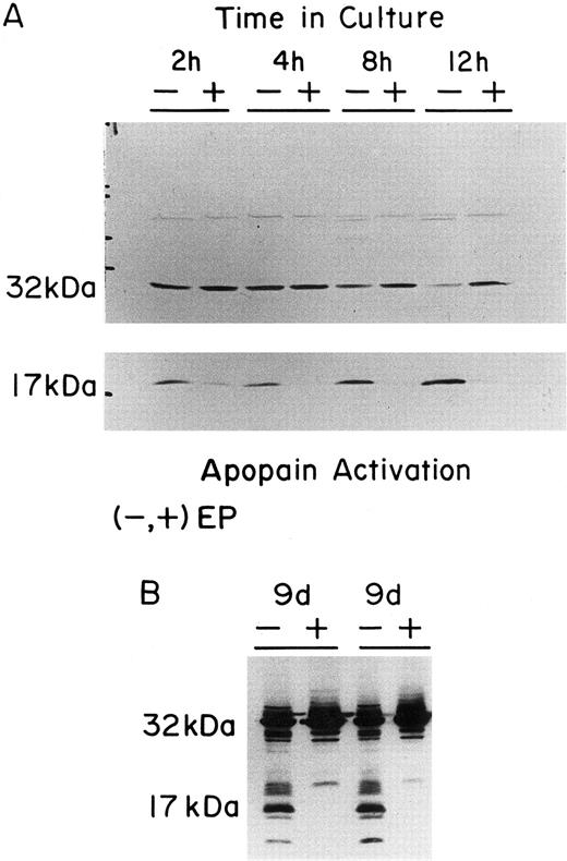 Fig. 6. Western blot analysis of Yama/CPP32/Apopain in FVA cells and Hu-ECFCs. (A) The lettering at the top of the panels shows the time of culture of FVA cells (2, 4, 8, or 12 hours) without EP (−) or with EP (+). All cell samples were prepared as described and subjected to electrophoresis on a 15% acrylamide gel. The upper panel shows depletion of the 32-kD proenzyme over 12 hours without EP (30 seconds of film exposure). The lower panel shows accumulation of the 17-kD apopain large peptide in cells cultured without EP (4 minutes of film exposure). (B) The panel shows the cleavage of the 32-kD proenzyme that occurs upon EP deprivation of Hu-ECFCs. Day-8 Hu-ECFCs were cultured for 24 hours without or with EP (day-9 EP− or day-9 EP+). The results of two different preparations of cells are shown. The 32-kD and 17-kD bands are labeled. All blots were probed using 1 μL of the rabbit polyclonal antiapopain antibody.