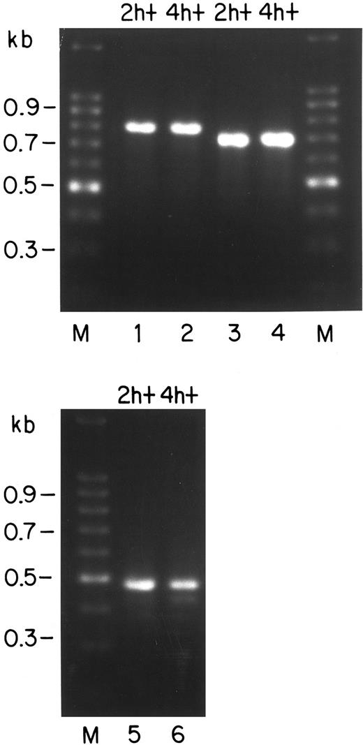 Fig. 7. RT-PCR identification of murine bcl-x transcripts expressed in FVA cells that were cultured for 2 or 4 hours with EP (designated 2 h+ and 4 h+, respectively). Reverse transcriptase was used to generate cDNA from total RNA of 2 h+ or 4 h+ cells. Each reverse transcriptase reaction was divided into three equal aliquots and subjected to PCR amplification using three primer sets. Marker lanes (M) show the 100-bp ladder (GIBCO-BRL), with sizes given on the left. Lanes 1 and 2 represent PCR with primers24 designed to amplify mRNAs for Bcl-XL (780 bp), Bcl-XS (591 bp), and Bcl-XΔTM (710 bp). Lanes 3 and 4 show samples generated with primers designed to detect mRNA containing an unspliced intronic sequence, ie, the mRNA for Bcl-X26β (expected size, ∼700 bp). Lanes 5 and 6 represent samples amplified by an additional set of primers designed to generate fragments from all three of the mRNAs for Bcl-XL (493 bp), Bcl-XS (304 bp), and Bcl-XΔTM (423 bp).25