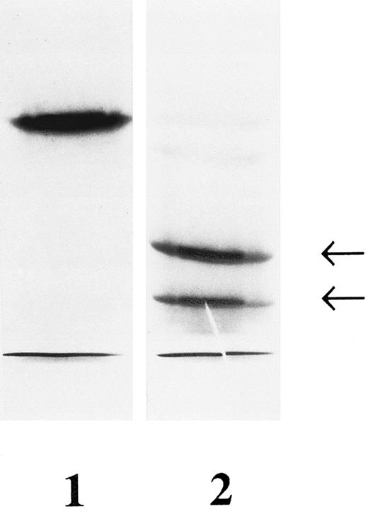 Fig. 1. PCR-SSCP analysis of exon 7 of the GPIIIa gene. A 165-bp DNA fragment corresponding to exon 7 of the GPIIIa gene was amplified by PCR using genomic DNA as a template and subjected to SSCP. Lane 1, control DNA; lane 2, father of the patient HS heterozygous for GT. The positions of the shifted bands observed with DNA of the patient's father are indicated.