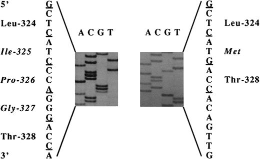 Fig. 2. Nucleotide sequence analysis of the genomic DNA fragment encompassing exon 7 of the GPIIIa gene. Genomic DNA from patient HS or control DNA was amplified using primers complementary to intronic sequences flanking exon 7 of the GPIIIa gene. The amplified 165-bp cDNA fragment was directly submitted to DNA sequence analysis. Nucleotides 1318 to 1323 encoding amino acids 325 to 327 of the normal GPIIIa gene are displayed on the left and the substitution of Ile325Pro326Gly327 by Met in the patient gene is shown on the right.