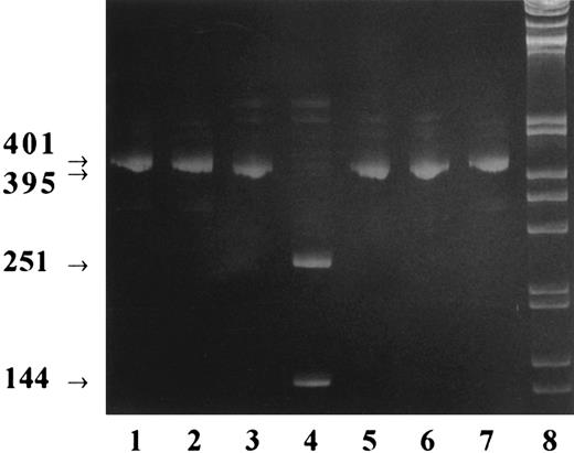 Fig. 4. BspHI restriction analysis of cDNA after RT-PCR of transfected CHO cell mRNA. Total RNA was purified from the transfected cell clones CHO β3-wt, CHO β3-met, and CHO β3-pro; reverse transcribed; and amplified by RT-PCR using specific primers. The amplified cDNA was digested by BspHI, and for each cell clone, undigested and digested cDNA was submitted to acrylamide gel electrophoresis. Lanes 1 and 2, β3-wild-type cDNA fragment of 401 bp before (lane 1) and after (lane 2) BspHI digestion; lanes 3 and 4, β3-met 395-bp cDNA fragment before (lane 3) and after (lane 4) digestion; lanes 5 and 6, β3-pro 395-bp cDNA fragment before (lane 5) and after (lane 6) digestion; lane 7, undigested wild-type β3 cDNA fragment; lane 8, 1-kb DNA ladder (GIBCO).