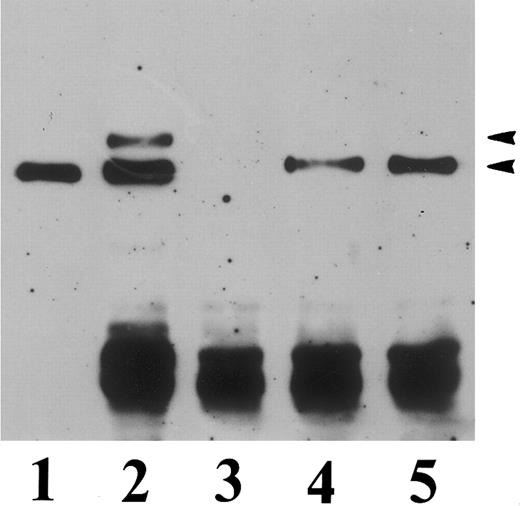 Fig. 7. Immunoprecipitation of recombinant human β3 integrin expressed in transfected CHO cells. Detergent extracts of mock-transfected CHO cells and positive transfectants were incubated with anti-β3 MoAb P37. The immunoprecipitates were resolved by 7% SDS-PAGE under reducing conditions, transferred to nitrocellulose, and visualized with an MoAb to αv (VNR139), reacting with hamster αv, and MoAb 4D10G3, reacting exclusively with human β3. The strong band visualized with goat antimouse IgG conjugated to horseradish peroxydase corresponds to precipitated MoAb P37. Lane 1, total platelet lysate serving as a positive control; lane 2, CHO β3-wild-type cells; lane 3, mock-transfected CHO cells; lane 4, CHO β3-met cells; lane 5, CHO β3-pro cells. The position of αv and β3 is indicated.