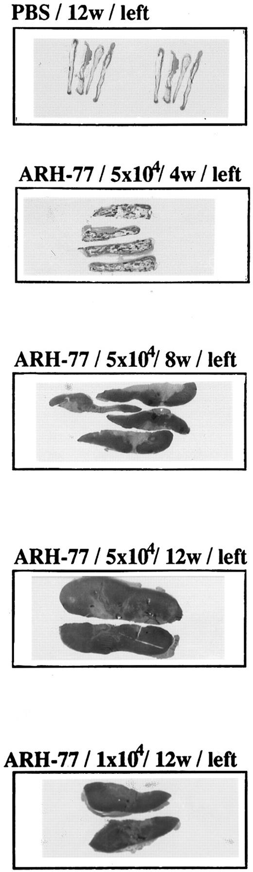 Fig. 2. Time- and dose-dependent growth of tumor cells in fetal bone implants. ARH-77 MM cells (1 × 104 or 5 × 104) or PBS was injected directly into the marrow cavity of the left fetal human bone implant of previously irradiated (400 cGy) SCID-hu mice. Mice were killed 4, 8, and 12 weeks later, and macroscopic sections of left human bone implants were stained with H&E.