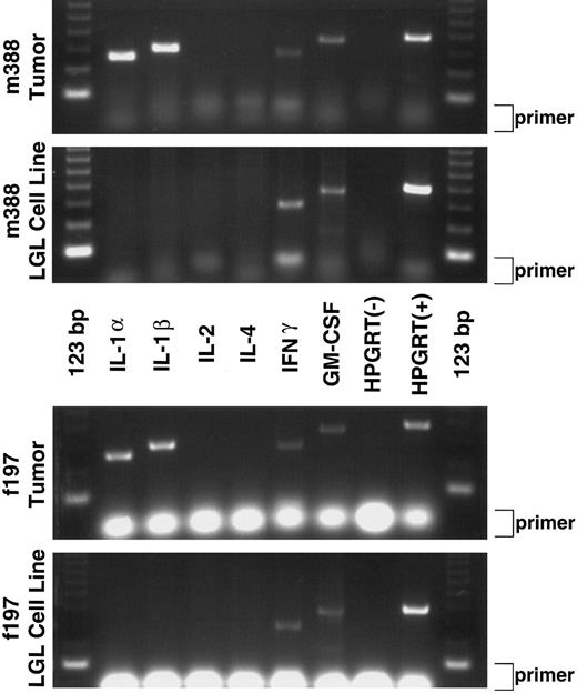 Fig. 2. RT-PCR cytokine analysis of GzmB-Tax transgenic tumors and derived LGL cell lines. The first and third panels show mRNA expression of IL-1α, IL-1β, IFNγ, and GM-CSF in the peripheral tumors of two different transgenic mice (m388 Tumor and f197 Tumor). The second and fourth panels show that the tumor-derived LGL cell lines express mRNAs for only IFNγ and GM-CSF (m388 LGL Cell Line and f197 LGL Cell Line). Negative and positive RT-PCR controls are shown in each panel and are labeled as HPGRT(−) and HPGRT(+), respectively. Excess primer for each RT-PCR reaction is indicated at the right side of each panel (primer).