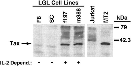 Fig. 5. Immunoblot analysis of Tax expression in LGL cell lines. Tax expression is indicated by the arrow on the left, with molecular mass markers shown on the right. LGL cell line dependency for IL-2 is indicated below each sample lane. Jurkat and MT2 cells were used for negative and positive controls of Tax expression, respectively.
