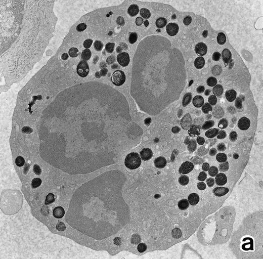 Fig. 7. (a) A PMN in patient no. 1 that appeared after 4 weeks of ATRA treatment. (MPO-stained section, original magnification × 14,900.) (b) Higher magnification of a portion of the cytoplasm in (a). Note that, in contrast to the cells in Fig 5, this cell contains two types of cytoplasmic granules, ie, MPO-positive spherical granules and MPO-negative, elongated or dumbbell-shaped, small granules (arrow), corresponding to the primary and secondary granules of neutrophils, respectively. (MPO-stained section, original magnification × 30,000.)