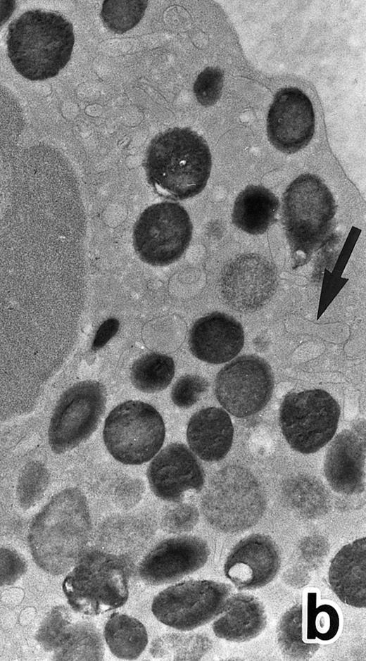 Fig. 7. (a) A PMN in patient no. 1 that appeared after 4 weeks of ATRA treatment. (MPO-stained section, original magnification × 14,900.) (b) Higher magnification of a portion of the cytoplasm in (a). Note that, in contrast to the cells in Fig 5, this cell contains two types of cytoplasmic granules, ie, MPO-positive spherical granules and MPO-negative, elongated or dumbbell-shaped, small granules (arrow), corresponding to the primary and secondary granules of neutrophils, respectively. (MPO-stained section, original magnification × 30,000.)
