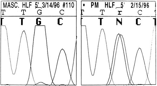 Fig. 5. DNA automatic sequence of the L-subunit IRE in a normal member (left) and the proband (right) of family 1. The highly conserved 5′-TGC-3′ motif is shown. In the affected member, an ambiguity can be seen (r/N) resulting from a G to A change present in the heterozygous state: overlapping signals corresponding to both guanine and adenine are visible. By contrast, only the guanine signal is visible in the normal DNA.