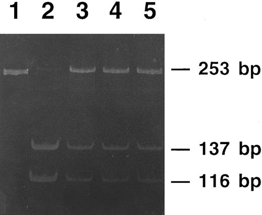 Fig. 7. Polyacrylamide gel electrophoresis of PCR products from members of family 2 digested with the restriction endonuclease Sac II. The undigested PCR product (lane 1) gives a single 253-bp band. DNA from a nonaffected member is completely digested (lane 2), showing two bands of 137-bp and 116-bp, respectively. DNAs from the three affected members of the family (lanes 3 to 5) show digestion of the normal allele (the 137-bp and the 116-bp bands), whereas the mutated allele is not digested and appears as the original 253-bp band.