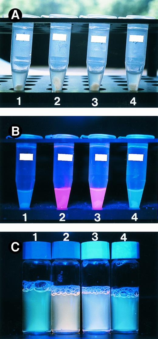 Fig. 5. The V190 mutant can function in mitochondria. Wild type and mutant ALAS-E proteins were expressed in QT6 cells. Panel A shows cell homogenate under normal lamp. The porphyrin accumulation in the cells was measured by exposing the cell homogenate (B) and culture supernatant (C) to UV light. Tube 1 contains cells transfected with control plasmid. Cell homogenate and culture supernatant expressing wild type ALAS-E (tube 2) displays an intense red fluorescence under UV lamp, indicating the presence of porphyrins. Expression of the V190 mutant (tube 3) also gave rise to red fluorescence, albeit of weaker intensity than wild type, while cell homogenate and culture supernatant transfected with the V426 mutant plasmid (tube 4) showed only marginal red fluorescence.