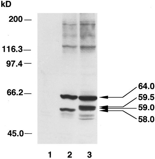 Fig. 6. Immunoblot analysis of ALAS-E transfected into QT6 fibroblasts. Extracts of wild type ALAS-E and V190 mutant ALAS-E expressed in QT6 were analyzed. Lane 1 represents nontransfected QT6 cells. Two major bands were seen in the mitochondrial fraction of cells transfected with wild type ALAS2 cDNA (lane 2). The larger band (64 kD) corresponds to the human ALAS-E precursor and the smaller band (58 kD) corresponds to the mature ALAS-E. In the V190 mutant fraction (lane 3), two bands are detected whose sizes are estimated to be 59.5 and 59 kD.