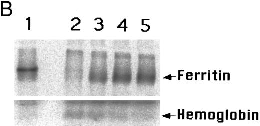 Fig. 4. Effect of chloroquine on intracellular radioiron distribution. Cells were labeled with 59Fe-labeled human diferric transferrin during the first 6 days of phase II (EPO-dependent phase, see Materials and Methods), then washed, and reincubated in fresh nonradioactive medium containing different concentrations of chloroquine. On day 9 of phase II, cells were harvested and lysed. (A) Results obtained by ferritin immunoprecipitation and heme extraction of three individual experiments obtained from cultures of three different normal donors. (B) Cell lysates were separated by SDS-PAGE followed by phosphor-imaging. Human placental ferritin and Hb were used as standards (not shown). Lane 1, 6 days in phase II, before treatment. Lanes 2 to 5, 9 days in phase II, chloroquine at 0, 5, 10, and 15 μmol/L, respectively.