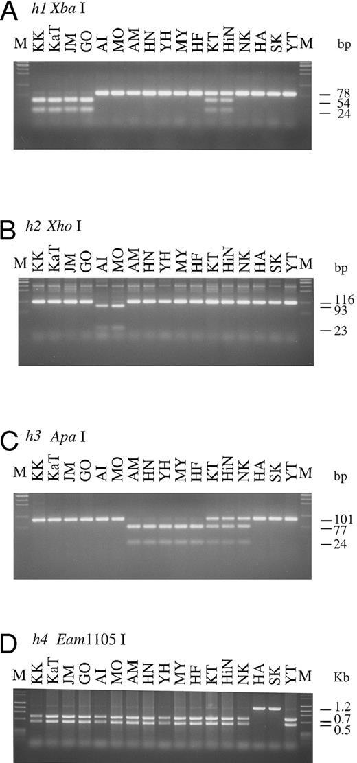Fig. 2. PCR-RFLPs for detection of each of mutant H and Se alleles. Profiles of PCR-RFLPs for detection of h1 (A), h2 (B), h3 (C), h4 (D), and h5 (E and F) alleles in H gene, and profiles of PCR-RFLPs for genotyping of Se gene (G and H) are presented. Initials of each individual are at the top. M, marker.