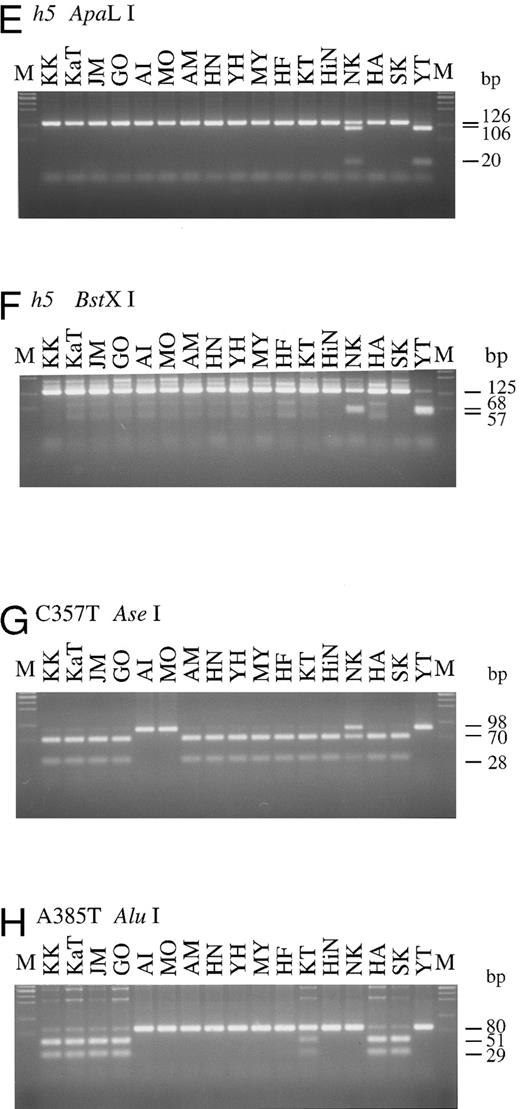 Fig. 2. PCR-RFLPs for detection of each of mutant H and Se alleles. Profiles of PCR-RFLPs for detection of h1 (A), h2 (B), h3 (C), h4 (D), and h5 (E and F) alleles in H gene, and profiles of PCR-RFLPs for genotyping of Se gene (G and H) are presented. Initials of each individual are at the top. M, marker.