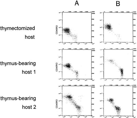Fig. 1. Failure to reconstitute naive (CD45RA+) T-helper cells in the thymectomized host. CD45 isotype expression was examined on gated CD4+ cells identified by PerCP. The dot plots depict CD45RA+ (FITC, FL1) cells versus CD45RO+ (PE, FL2) cells. Columns A and B show the distribution of CD45 isoform expression at 6 and 9 months, respectively, after allogeneic BMT.