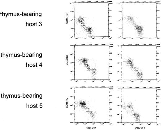 Fig. 1. Failure to reconstitute naive (CD45RA+) T-helper cells in the thymectomized host. CD45 isotype expression was examined on gated CD4+ cells identified by PerCP. The dot plots depict CD45RA+ (FITC, FL1) cells versus CD45RO+ (PE, FL2) cells. Columns A and B show the distribution of CD45 isoform expression at 6 and 9 months, respectively, after allogeneic BMT.