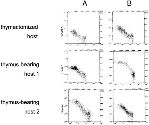 Fig. 3. Normal reconstitution of CD45RA+ T cells of the CD8+ subset in the thymectomized and the thymus-bearing hosts. CD45 isotype expression was examined on gated CD8+ cells identified by PerCP. The dot plots depict CD45RA+ (FITC, FL1) cells versus CD45RO+ (PE, FL2) cells. Columns A and B show the distribution of CD45 isoform expression at 6 and 9 months, respectively, after allogeneic BMT. Absolute counts of CD8+ cells at 6 and 9 months were 333/μL and 587/μL in the thymectomized host, 31/μL and 54/μL in the thymus-bearing host no. 1, 185/μL and 371/μL in host no. 2, 122/μL and 165/μL in host no. 3, 287/μL and 218/μL in host no. 4, and 50/μL and 41/μL in host no. 5.