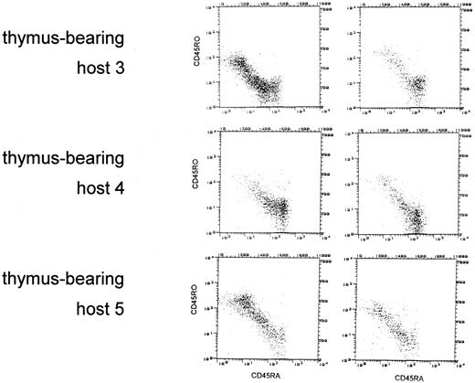 Fig. 3. Normal reconstitution of CD45RA+ T cells of the CD8+ subset in the thymectomized and the thymus-bearing hosts. CD45 isotype expression was examined on gated CD8+ cells identified by PerCP. The dot plots depict CD45RA+ (FITC, FL1) cells versus CD45RO+ (PE, FL2) cells. Columns A and B show the distribution of CD45 isoform expression at 6 and 9 months, respectively, after allogeneic BMT. Absolute counts of CD8+ cells at 6 and 9 months were 333/μL and 587/μL in the thymectomized host, 31/μL and 54/μL in the thymus-bearing host no. 1, 185/μL and 371/μL in host no. 2, 122/μL and 165/μL in host no. 3, 287/μL and 218/μL in host no. 4, and 50/μL and 41/μL in host no. 5.
