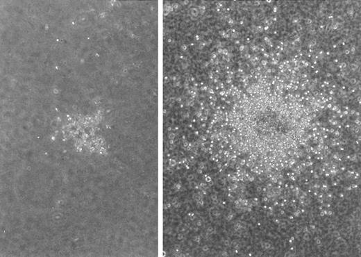 Fig. 2. Increases in GM-CFC colony counts and size in the presence of F-1. Bone marrow cells were cultured in agarose containing abdominal wall-conditioned medium with (right) or without (left) 10 μg/mL of F-1 for 7 days.