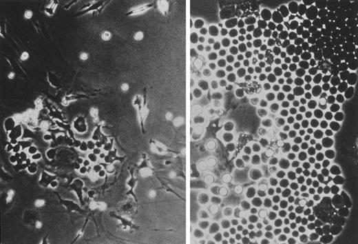 Fig. 7. Cobblestone colonies of P-HSCs cultured with nontreated MS-5 (left) or MS-5 pre-incubated with 5 μg/mL of linolenic acid (right) for 6 weeks.